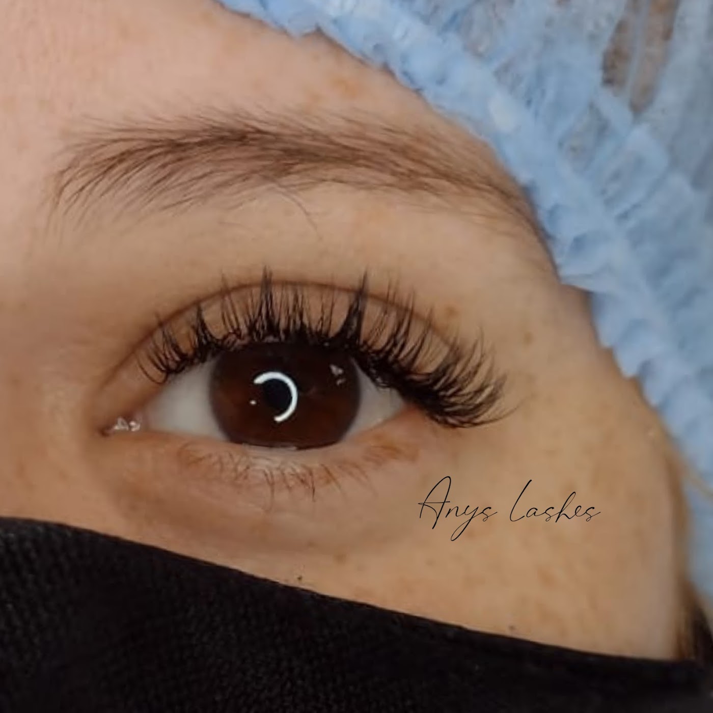 Anys Depilacion